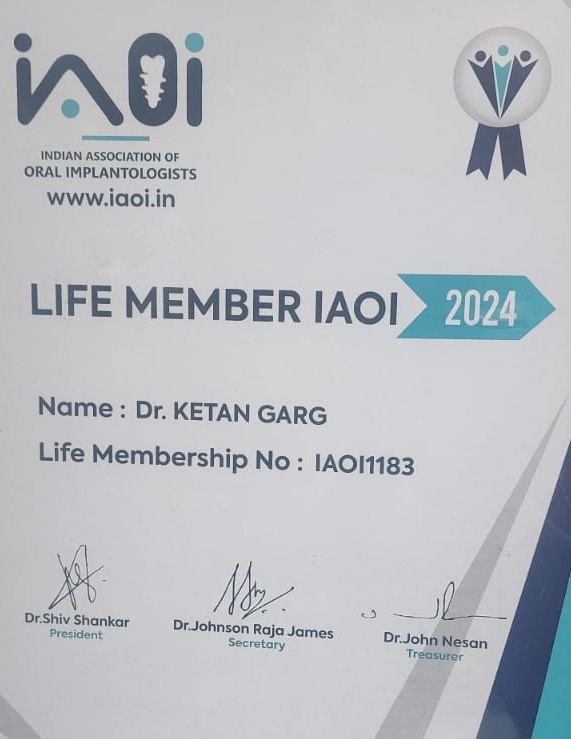 A certificate from the Indian Association of Oral Implantologists (IAOI) identifying Dr. Ketan Garg as a "LIFE MEMBER IAOI 2024" with Life Membership No: IAOI1183 and signatures of the President, Secretary, and Treasurer.