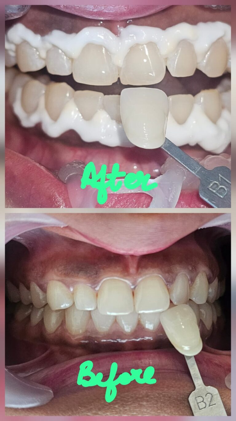 WhatsApp Image 2025-06-05 at 1.33.35 PM (1)